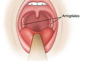 Alexandria endoscopic mouth tour uvula tonsils